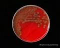 Streptococcus pneumoniae (pneumococcus) growing on blood agar plate
